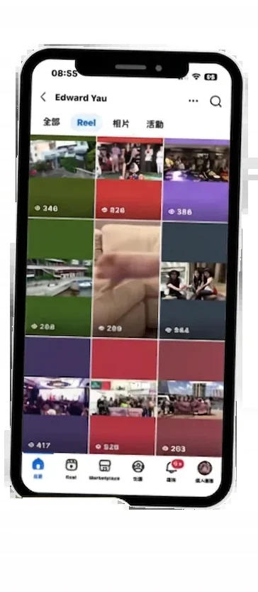 Edward 診斷前內容表現